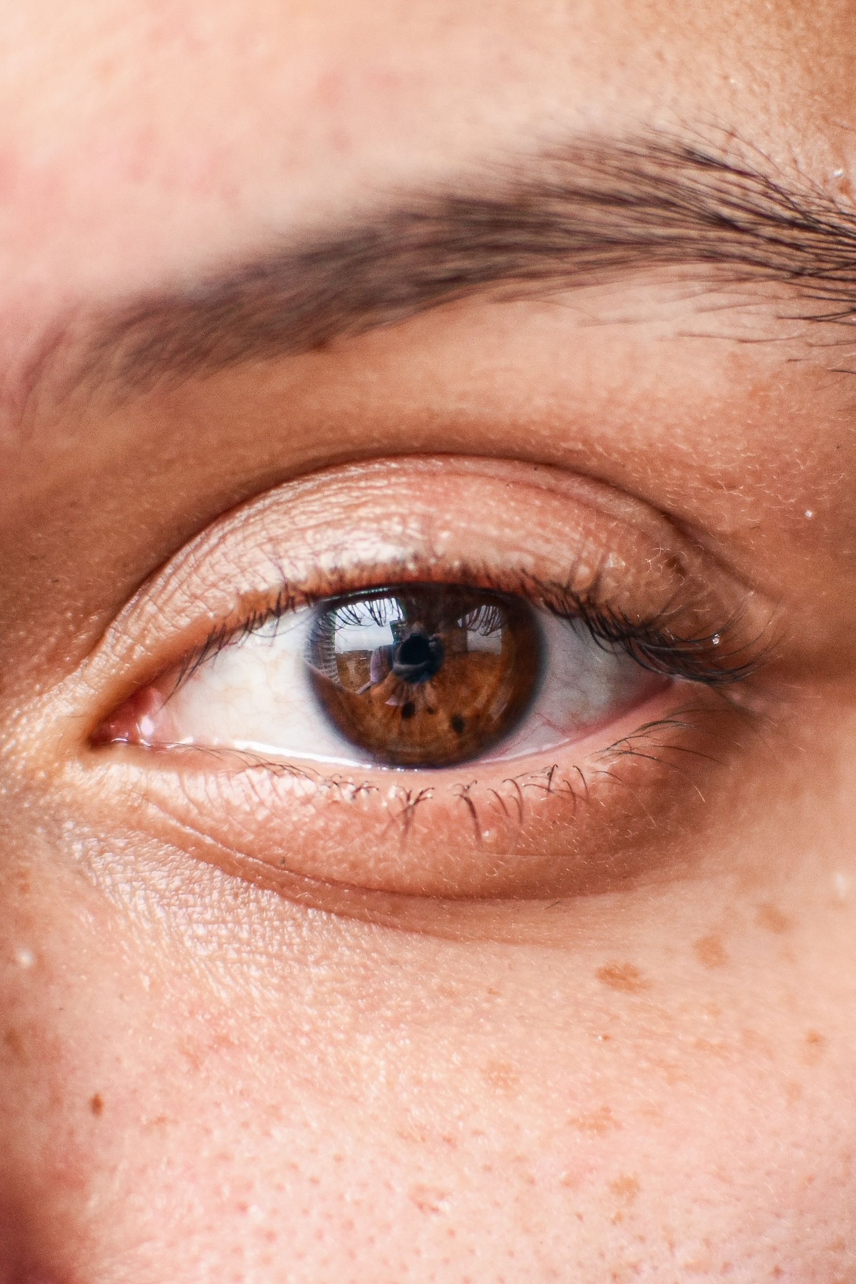 Close up of a person's eyes with milia around | Source: Pexels