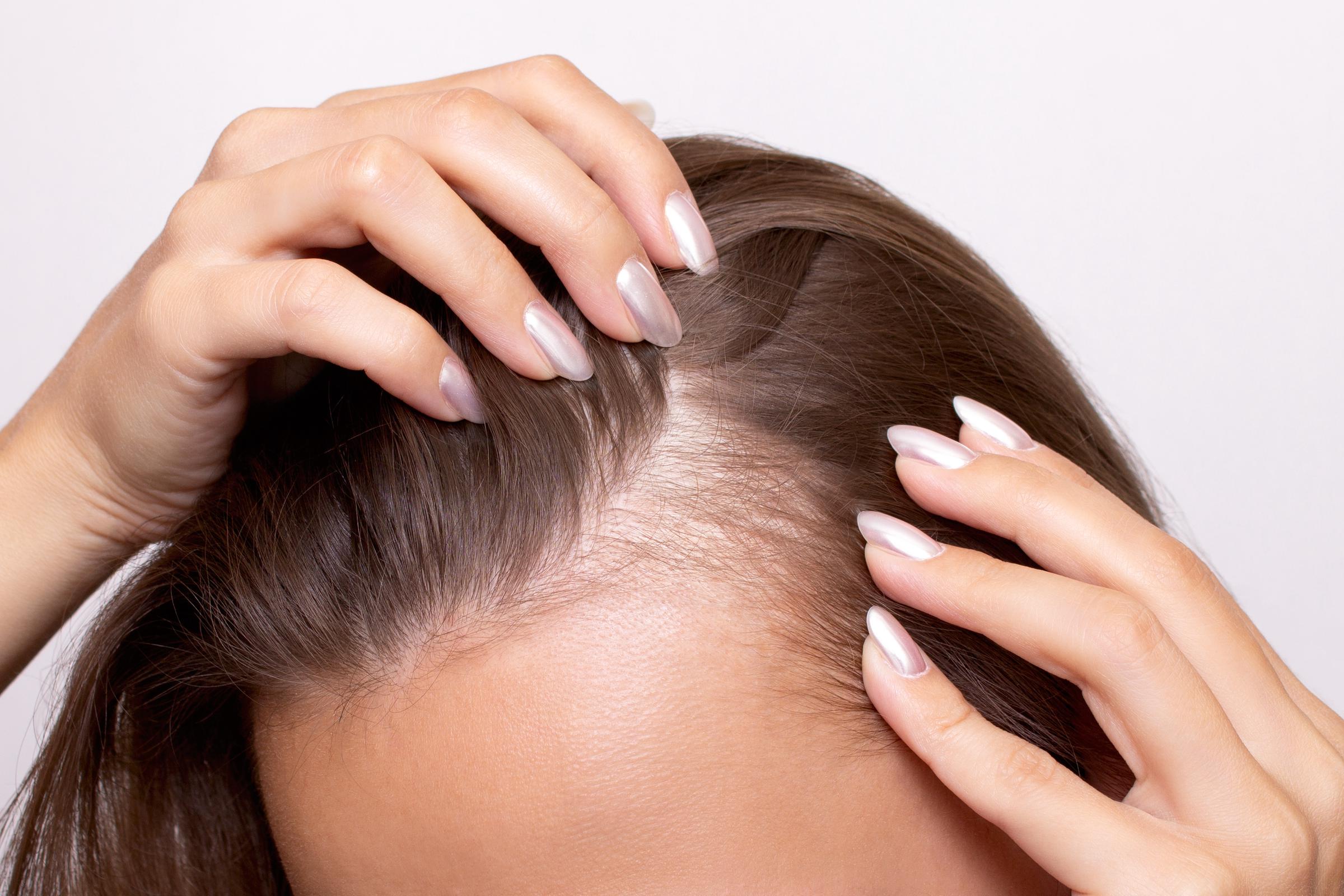 A close-up of a woman's gradually thinning hair | Source: Getty Images