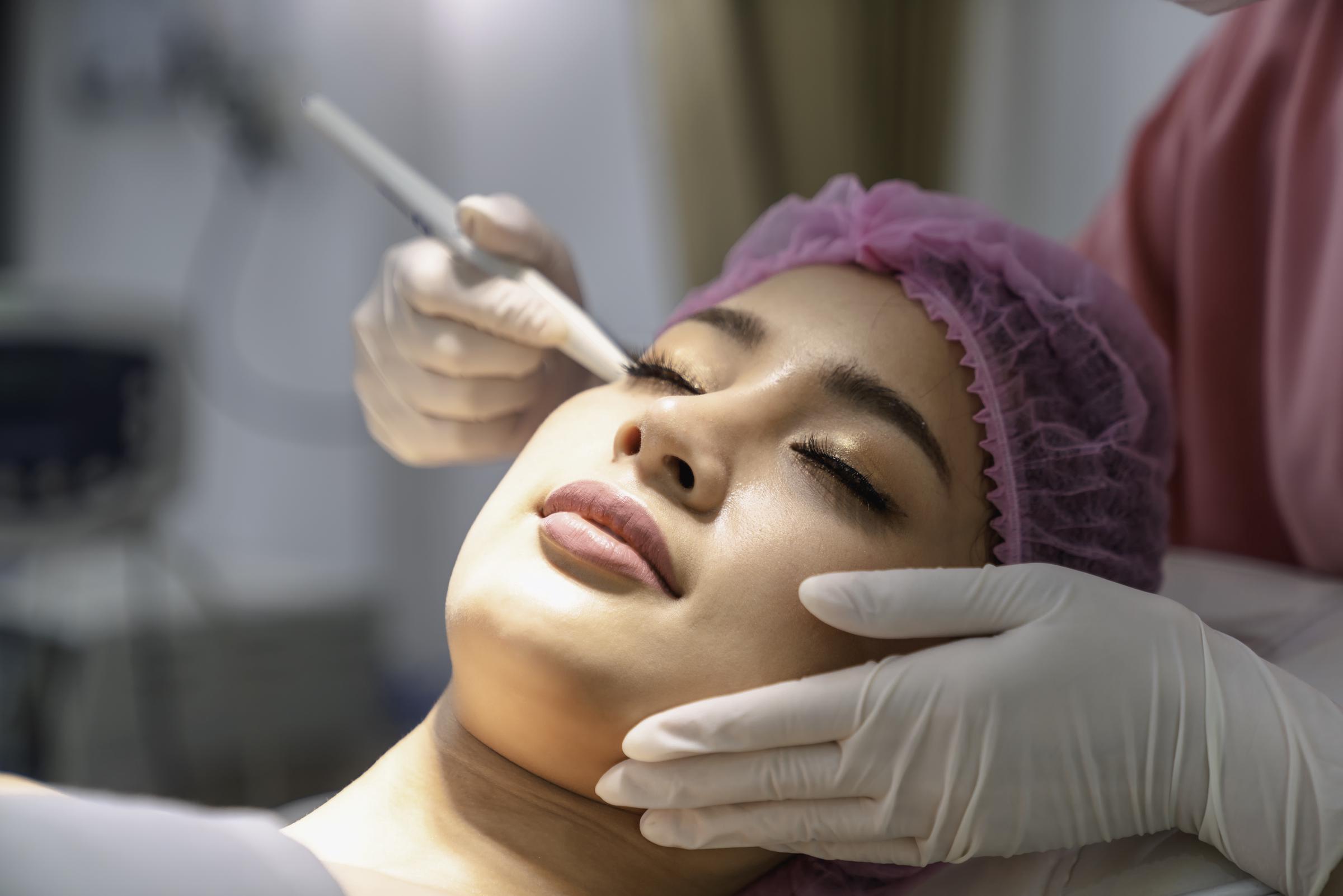 A woman undergoing a facial microdermabrasion procedure | Source: Getty Images