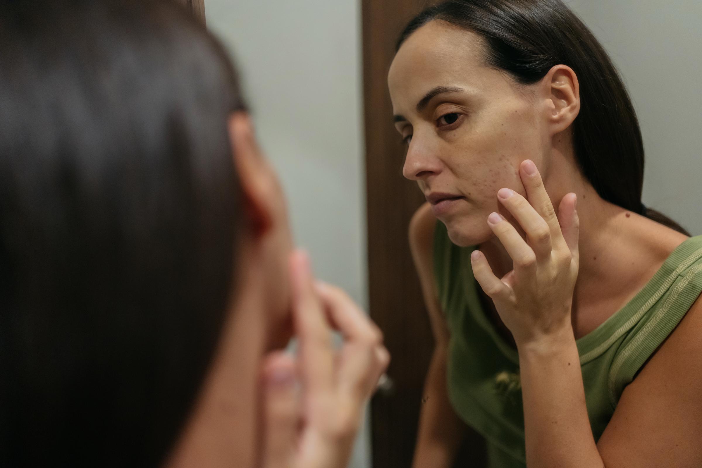 A woman examining her acne scars | Source: Getty Images