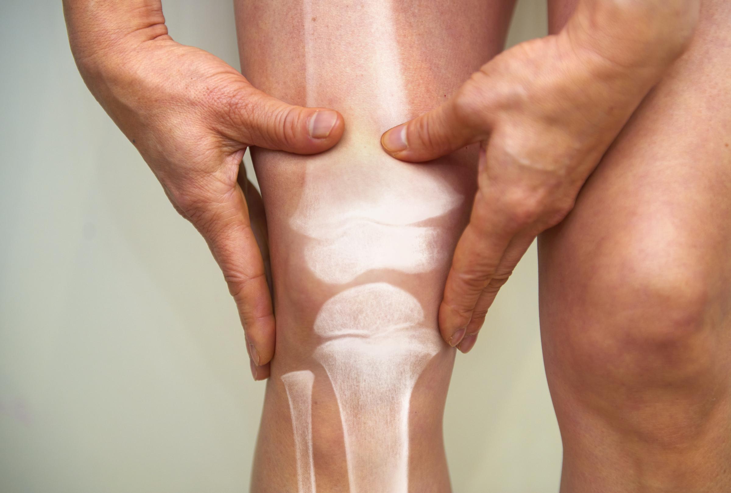 A woman holding her knee | Source: Getty Images