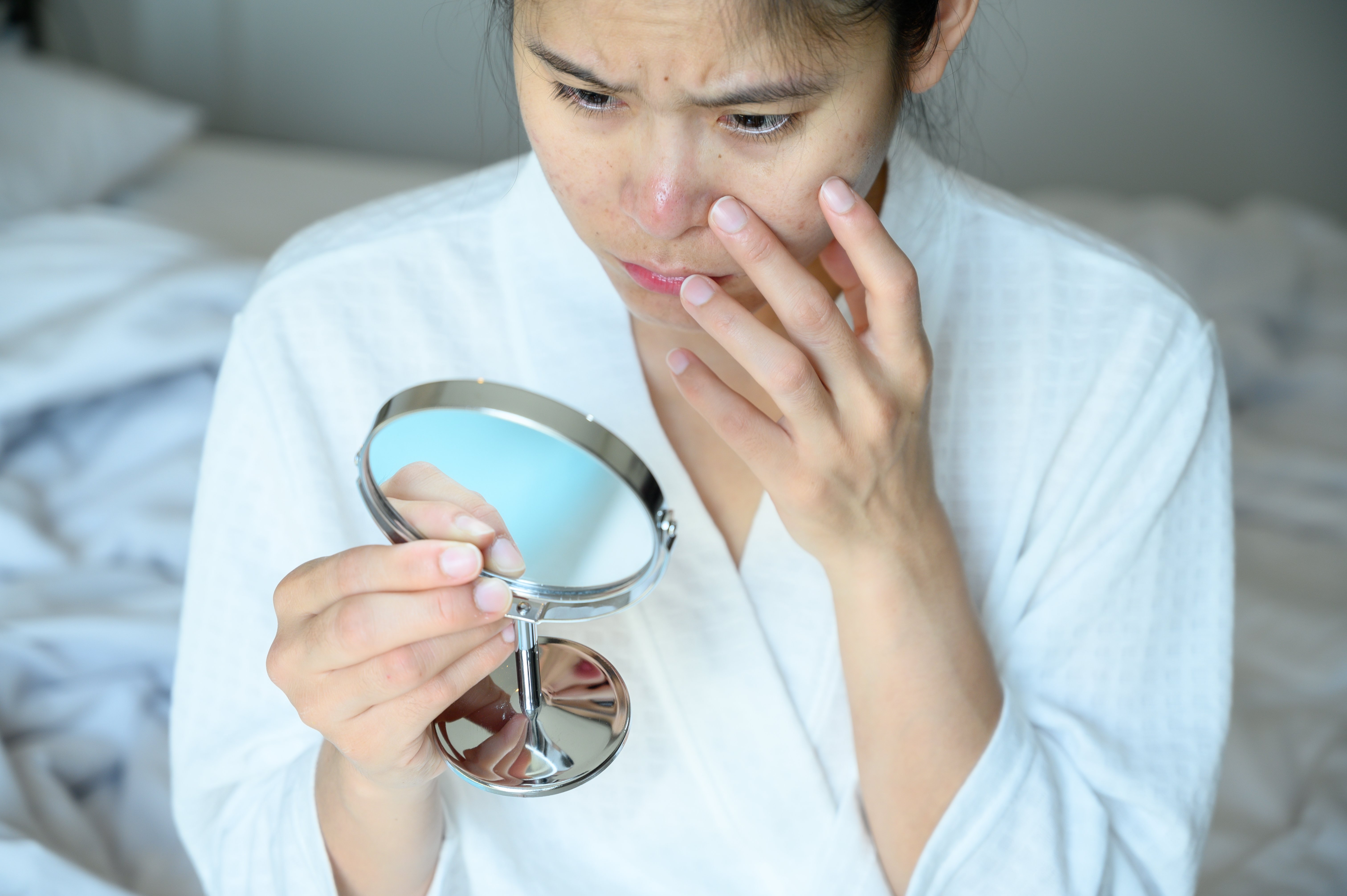 Woman with problem skin. | Source: Getty Images