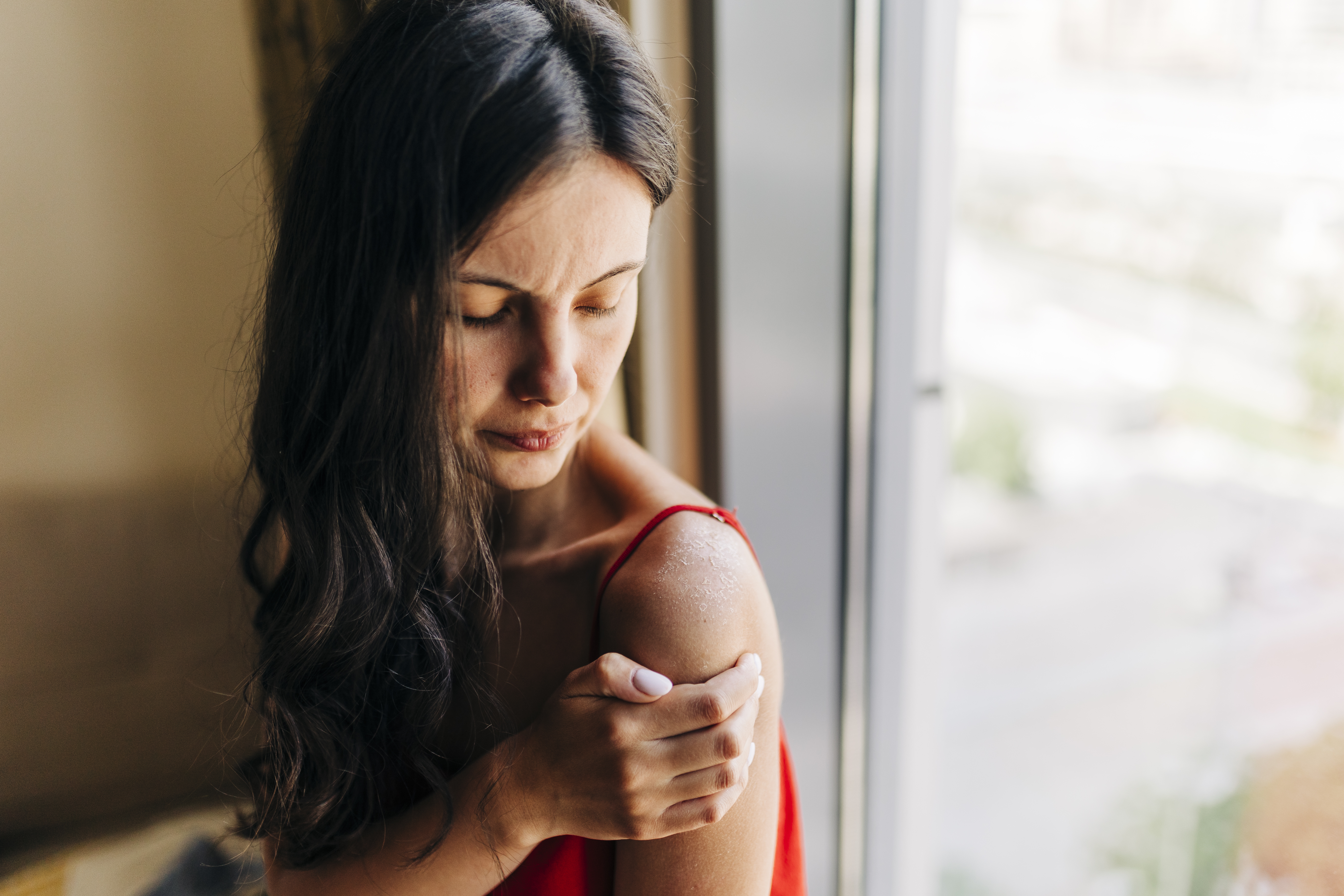 Woman with burn. | Source: Getty Images