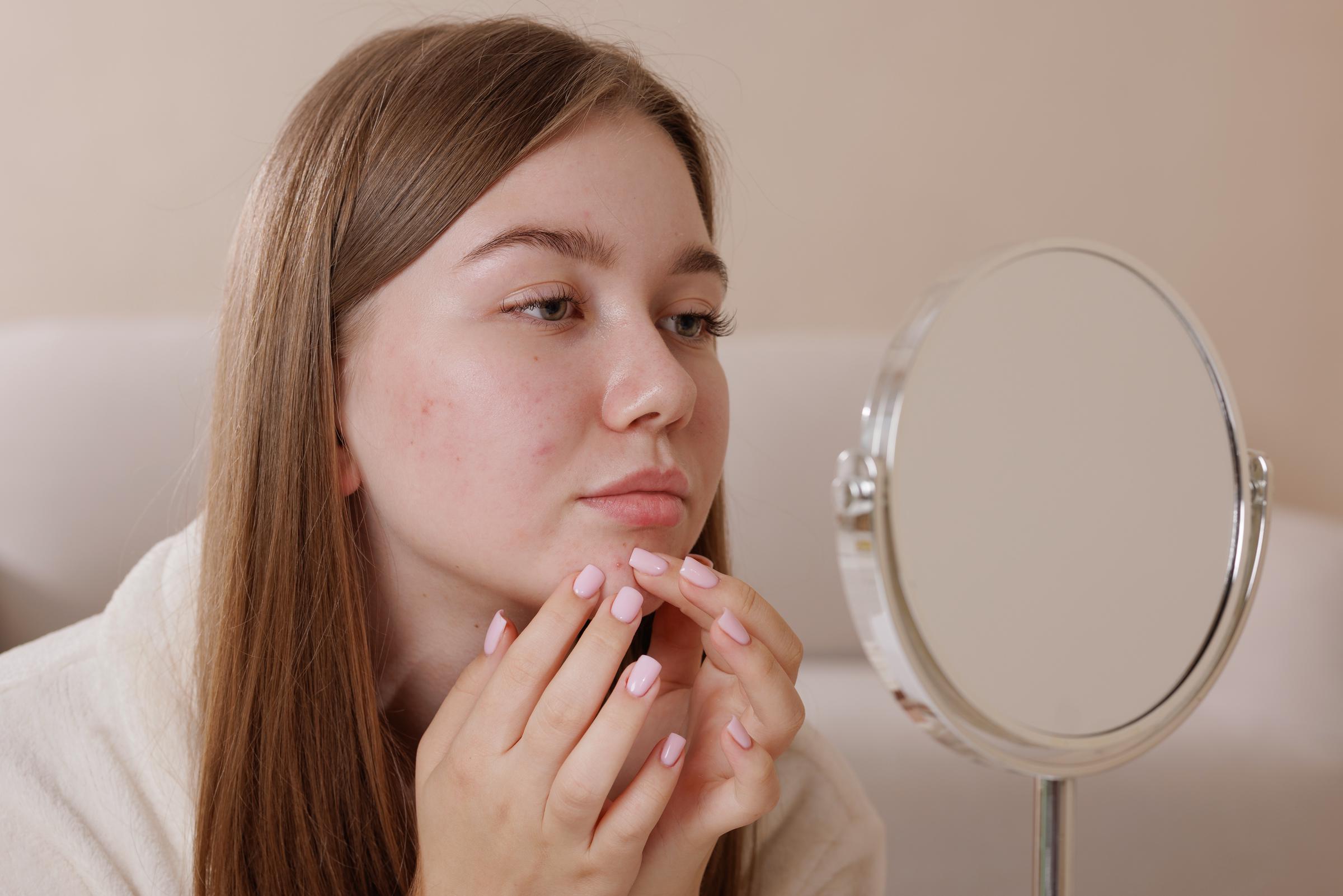 A teenager inspects her face in the mirror | Source: Getty Images