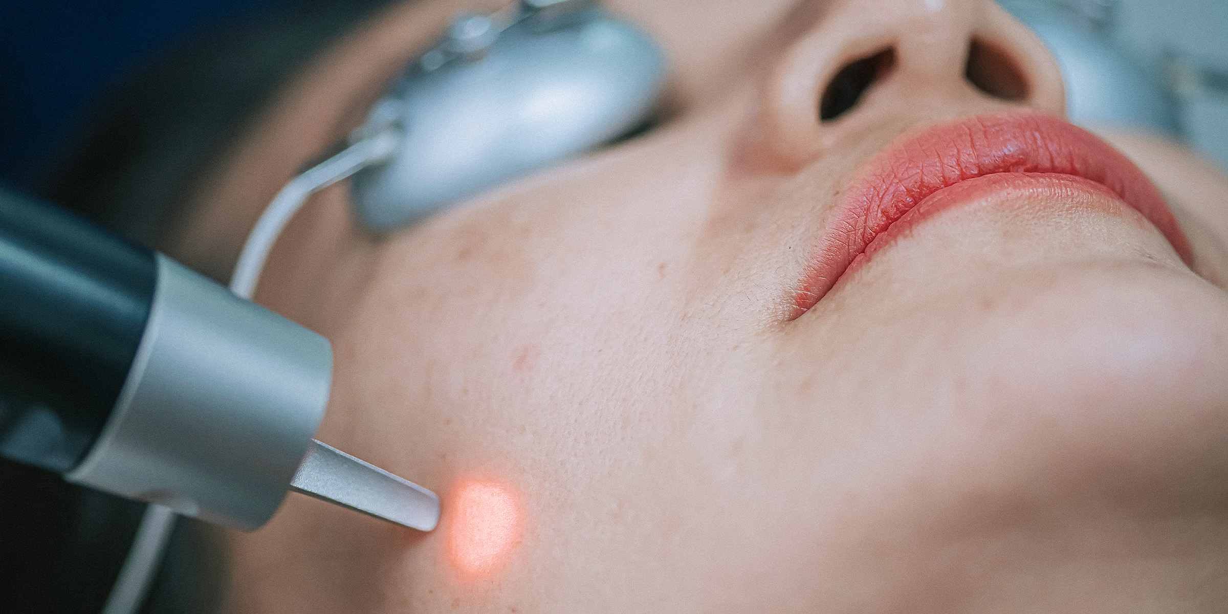 A woman undergoing laser treatment | Source: Getty Images